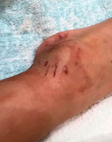 В Австралии трехметровый питон напал на 5-летнего мальчика, укусил и пытался утопить в бассейне