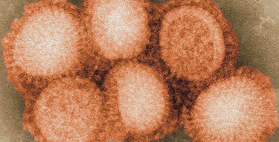 Лабораторно подтвержденные случаи COVID-19 и гриппа H1N1 регистрируются в Могилевской области