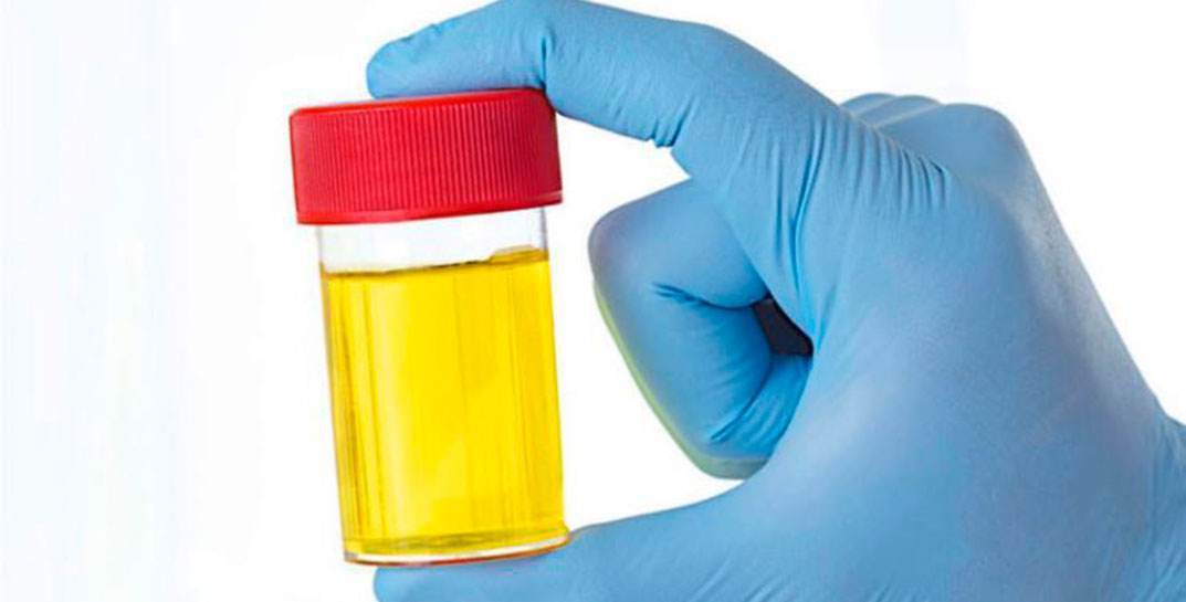 В Сморгони пьяный мужчина метнул в окно бутылку с мочой и попал в дворника