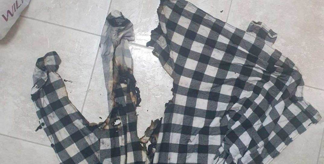 В Бобруйске 12-летний мальчик варил пельмени, когда на нем загорелась рубашка