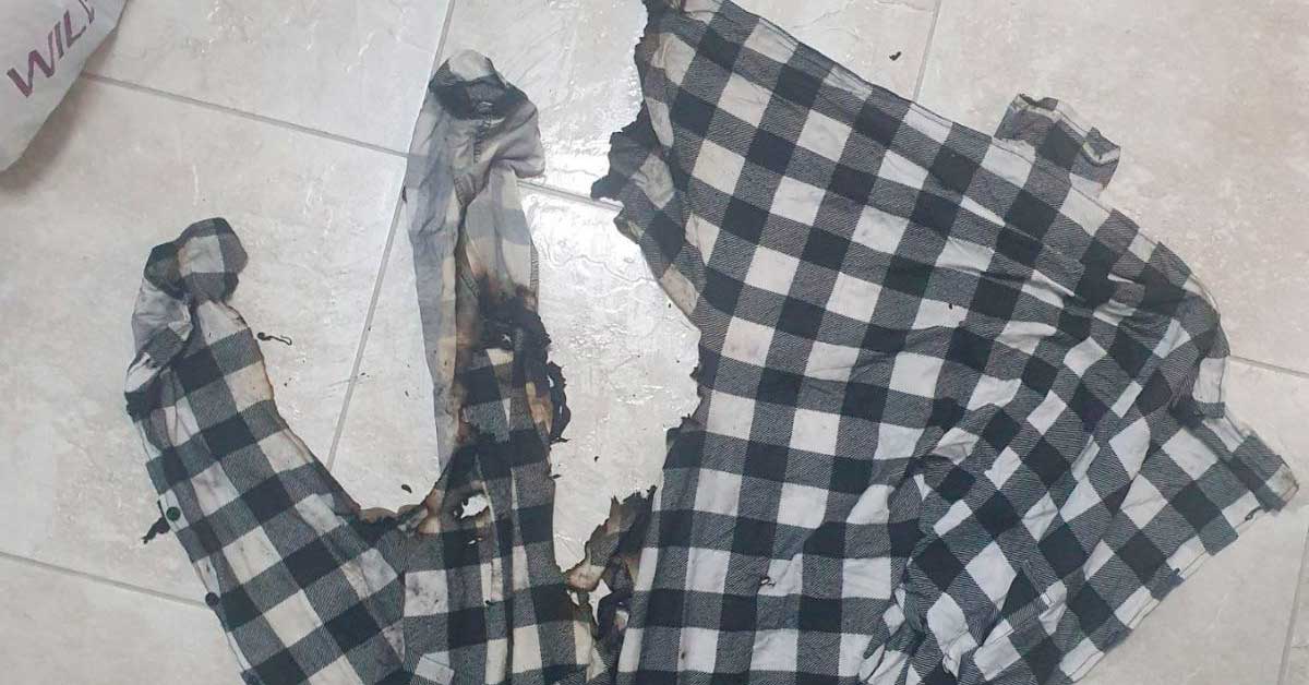 В Бобруйске 12-летний мальчик варил пельмени, когда на нем загорелась рубашка