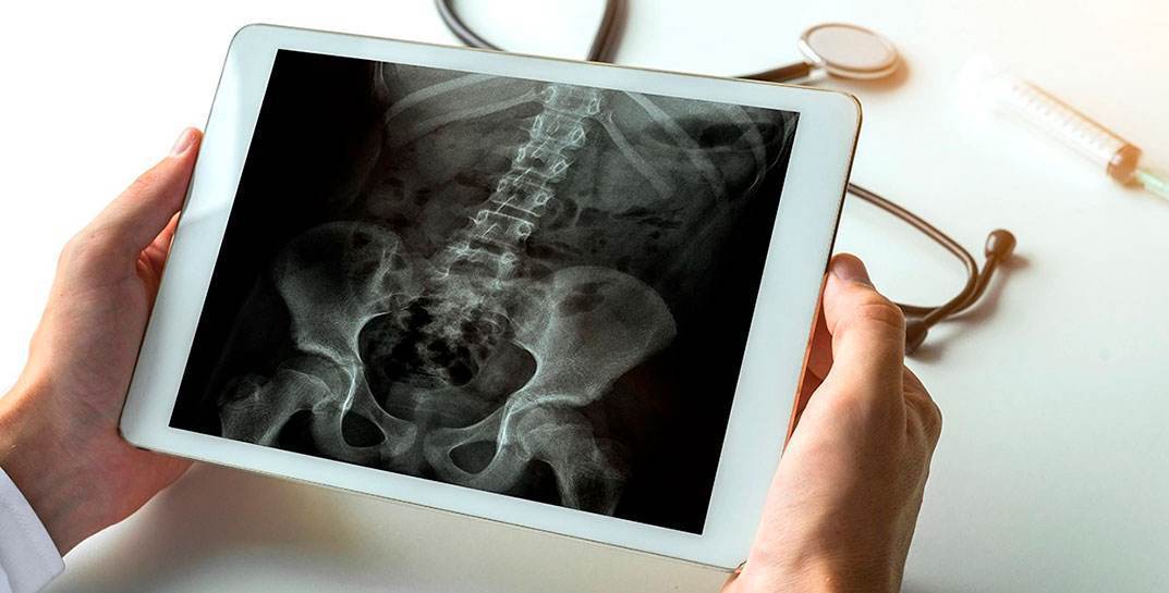 В Гродно мужчину прижало покатившимся автомобилем — он получил перелом костей таза и штраф