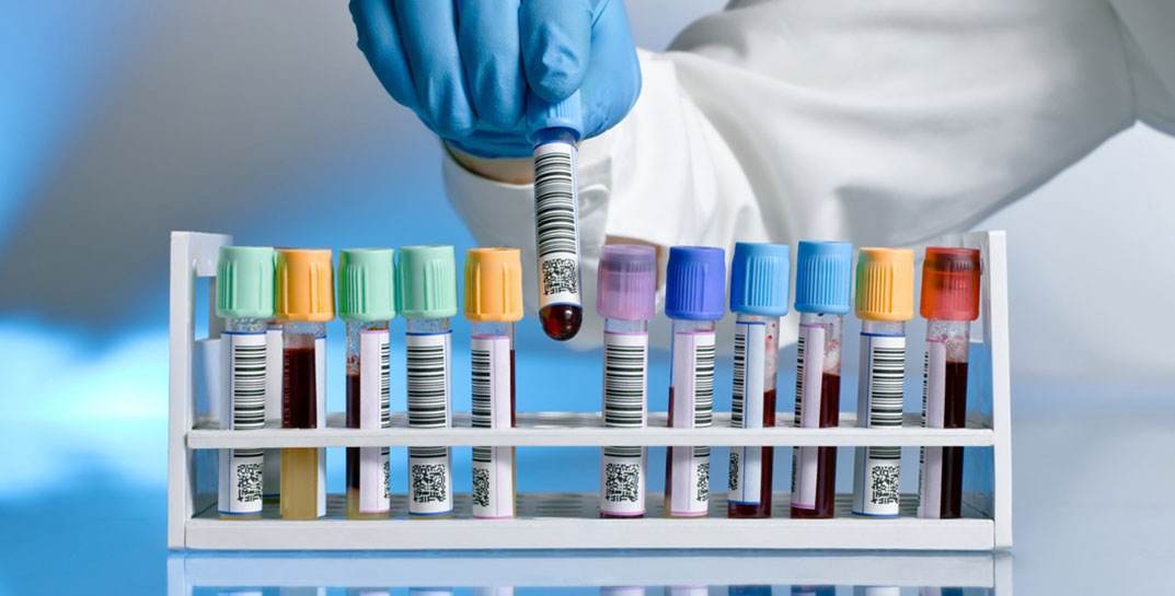 Минздрав Беларуси заявил о внедрении теста, который выявляет более 60 видов рака