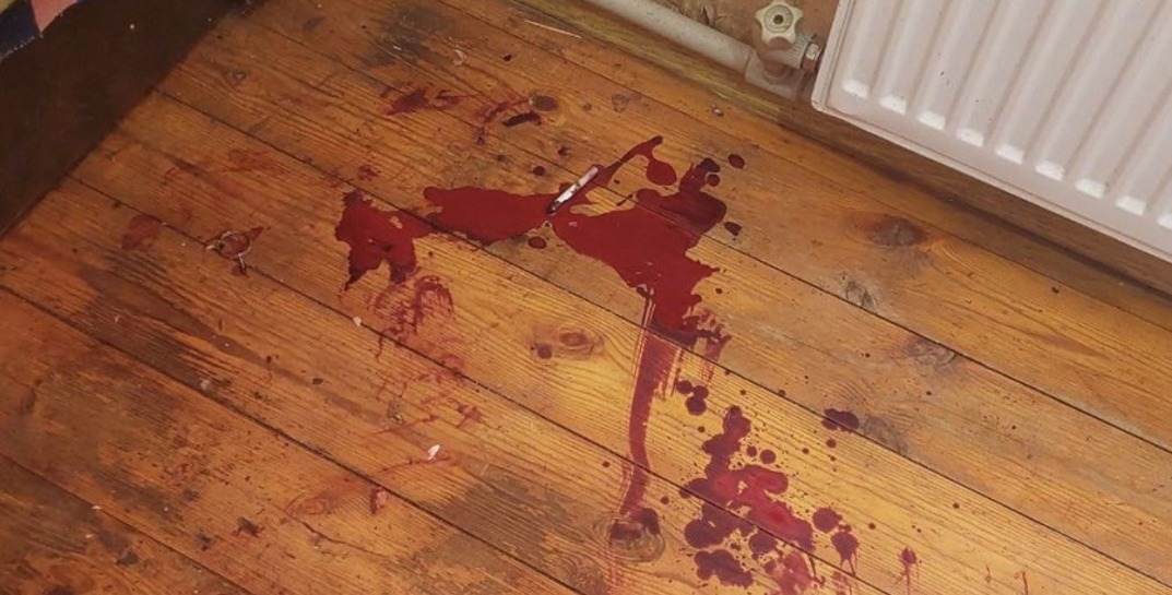 Пьяный бобруйчанин разбирал дома гранату — она взорвалась