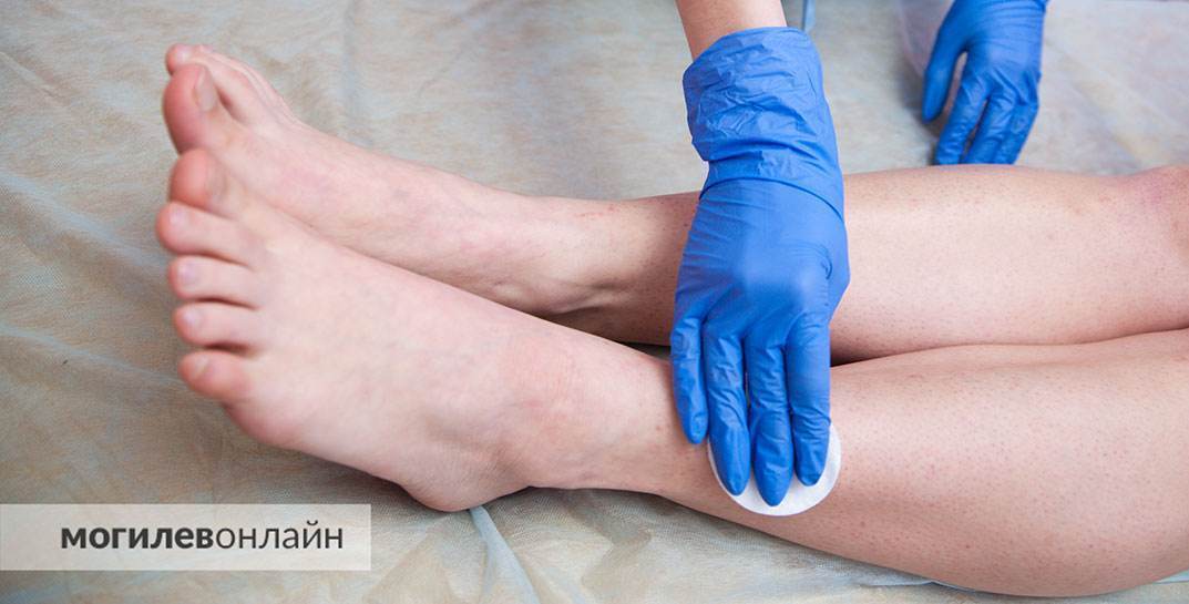 В Минске работница салона красоты так разволновалась, что убежала от налоговой через окно