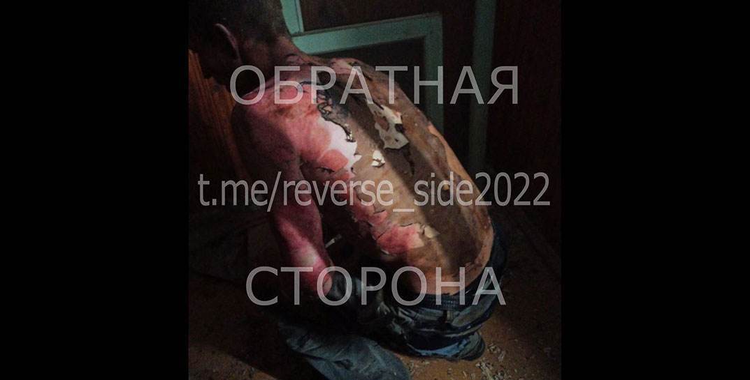 Пастух из Миорского района за один вечер угнал трактор, попал в ДТП и чуть не сгорел на пожаре