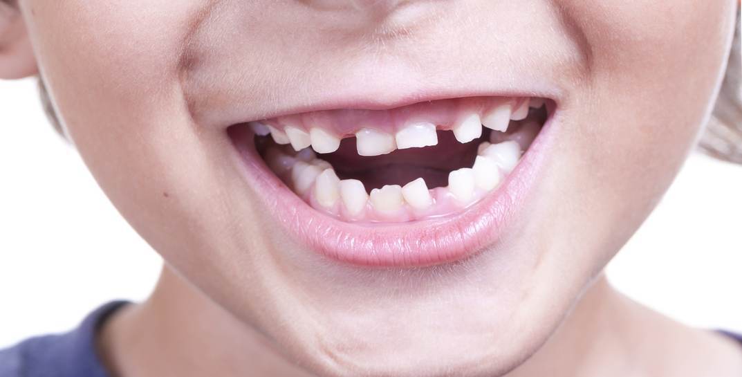 Ученые создали первое в мире лекарство, которое позволит вырастить новые зубы