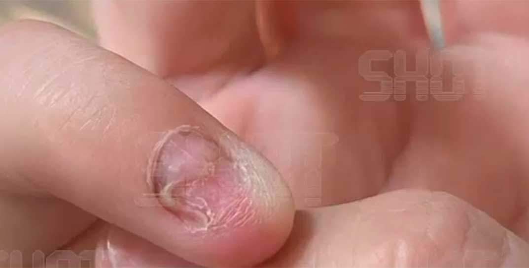 В России шеллак стал расщеплять ногти после маникюра. Говорят, дело в том, что импортные качественные материалы подорожали на 15-20%