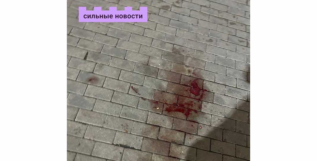 Вчера из окна общежития в Гомеле выпал студент. Сейчас парень в реанимации
