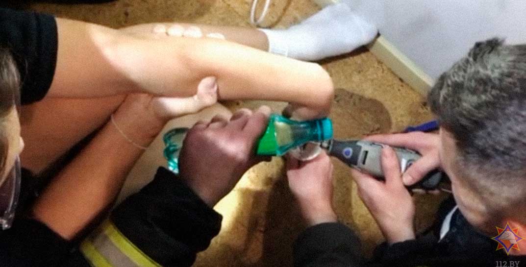 Спасатели достали из блендера палец 16-летней минчанки, которая готовила торт