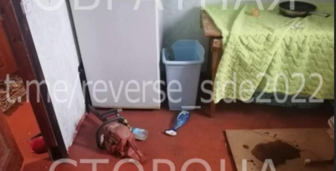 В Жлобине парень облил свою 19-летнюю жену бензином и поджег из-за того, что она весь вечер сидела в телефоне