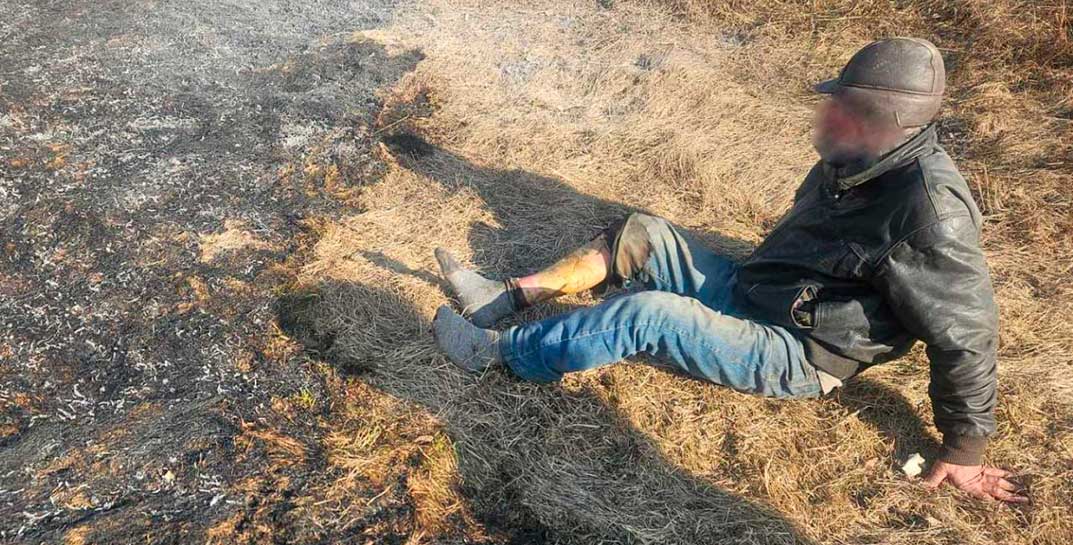 В Могилеве пьяный мужчина спал в сухой траве и курил. В итоге в этой траве он и обгорел