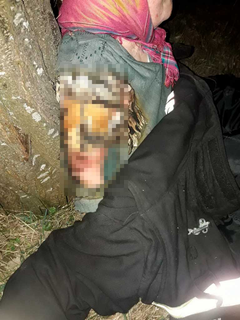 В Могилевской области две пенсионерки получили ожоги, сжигая траву. Одна из женщин не выжила