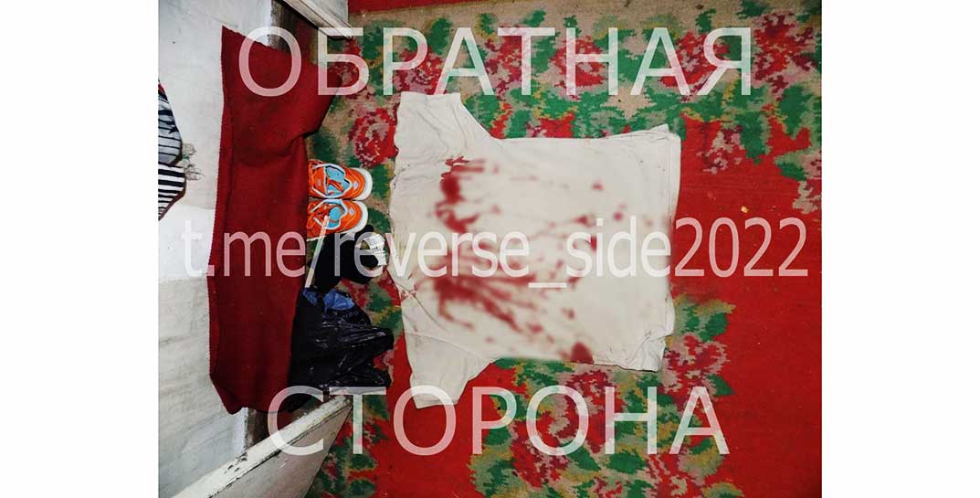 В Костюковичах мужчина пытался выгородить сожительницу-пенсионерку, которая воткнула ему нож между лопаток. Не вышло