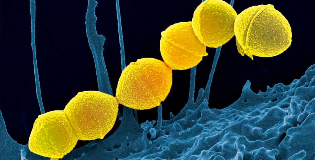 В Японии распространяется «плотоядная бактерия»: в этом году уже зафиксировано 977 случаев болезни