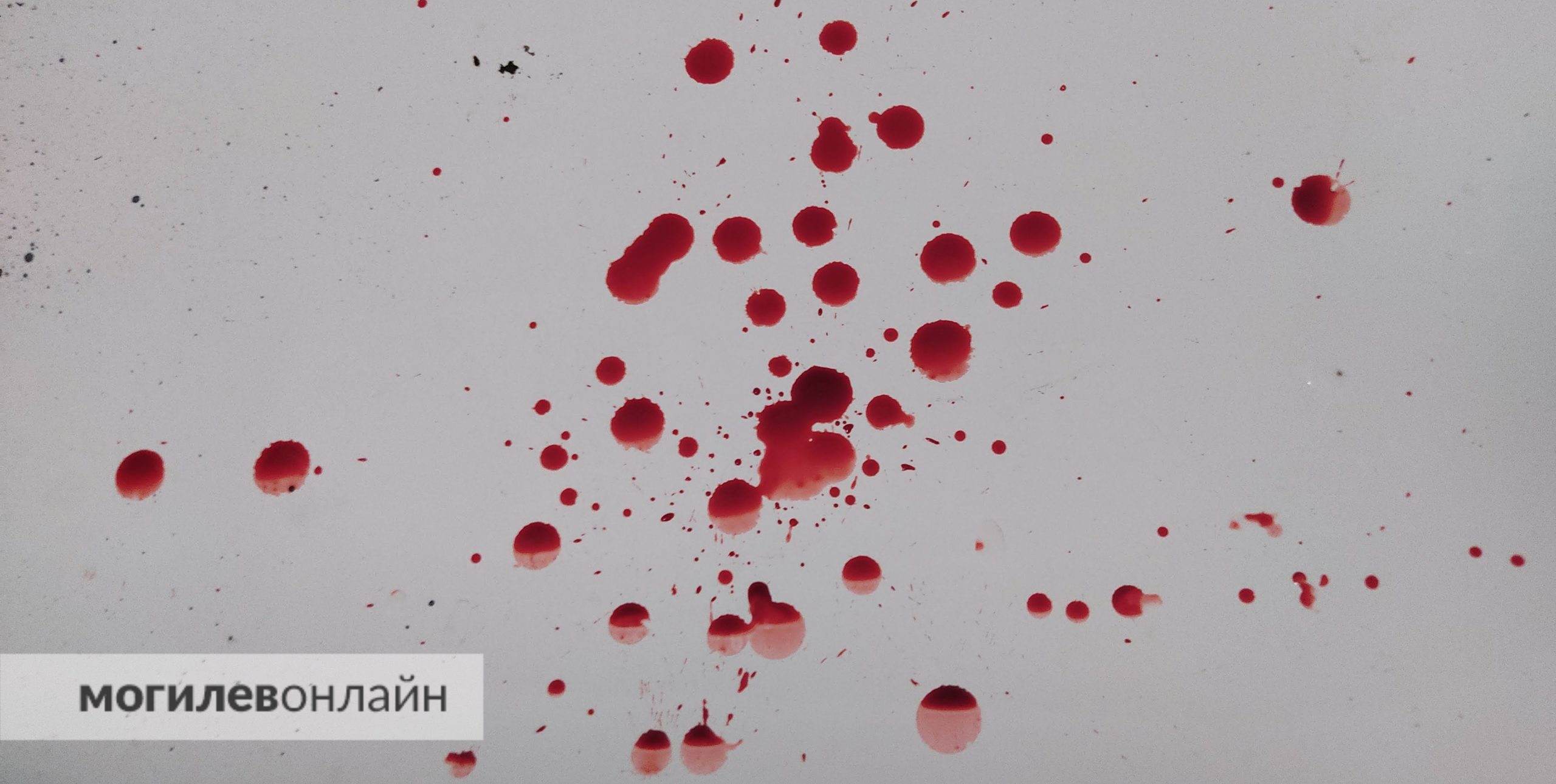 На Витебщине женщины подрались из-за спора о методах воспитания детей — в итоге одна другой сломала челюсть