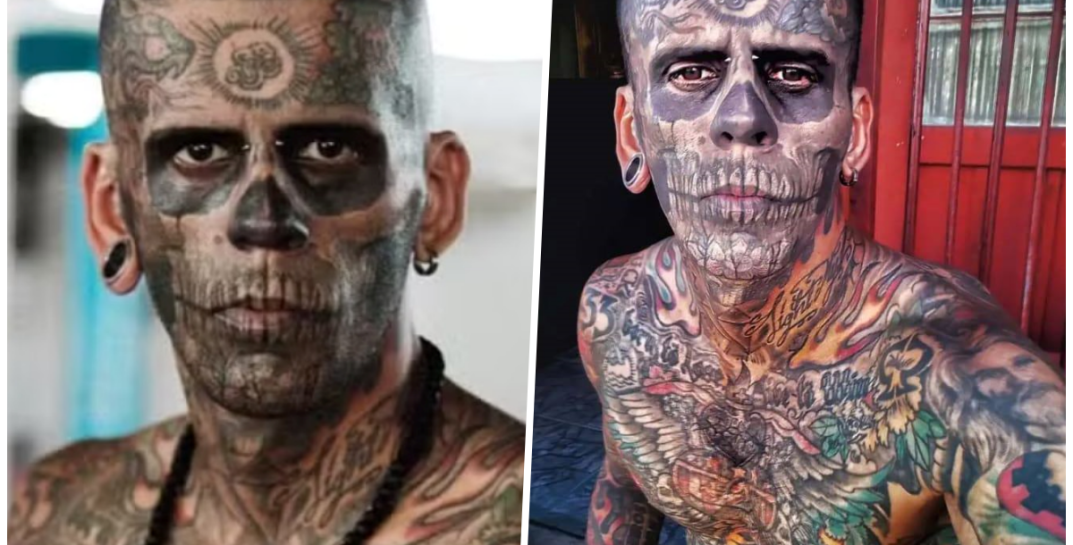 «Самый татуированный бразилец» сводит все татуировки. Как он теперь выглядит?