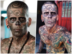 «Самый татуированный бразилец» сводит все татуировки. Как он теперь выглядит?