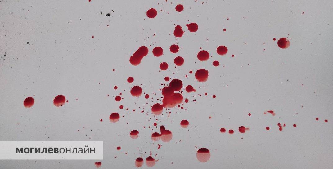 Под Минском дачник напал на свою соседку с топором и отрубил ей 4 пальца