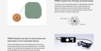 Слепота побеждена! Ученые создали чип, который обходит поврежденные участки глаза